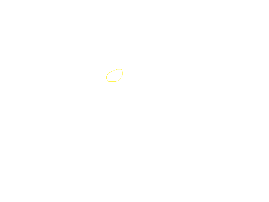 Gästehaus Post in de ochtendzon. Dit jaar de kamer links op de hoek op de tweede verdieping (die met het openstaande klapkantelraam)